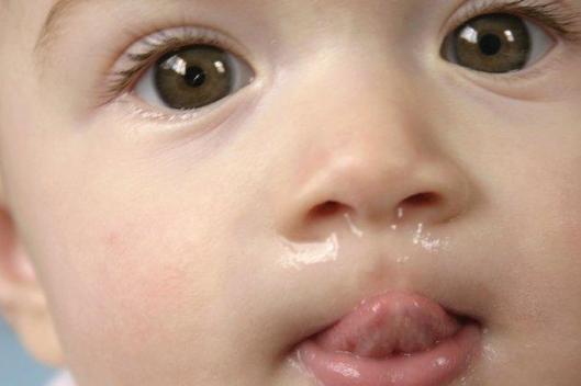 Baby-Running-Nose-with-Sneezing-Cough-Teething-Medicine